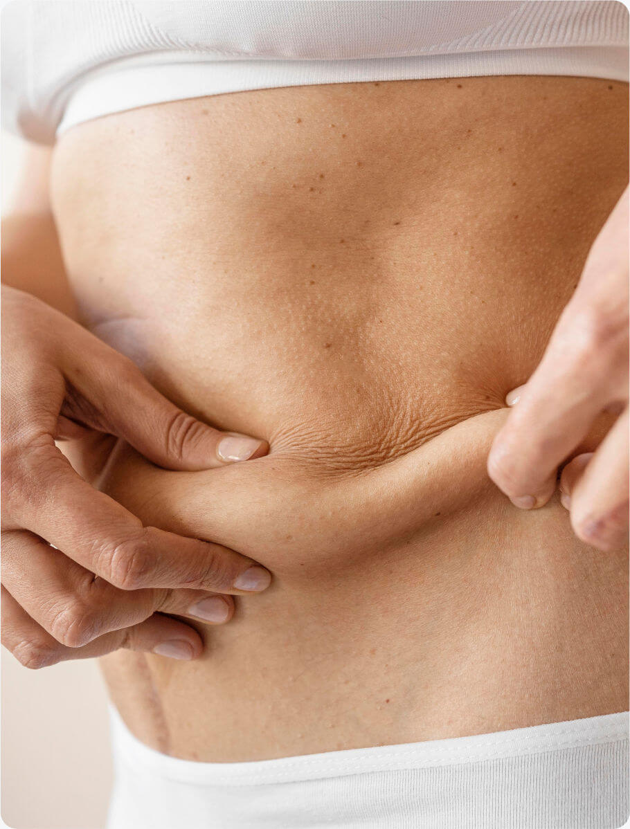 Banner - Verdacht auf Lipödem?